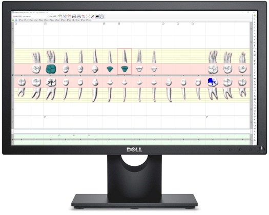 2763_monitor_2